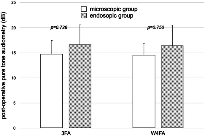 Endoscopic Ear Surgery for Congenital Cholesteatoma in Children.