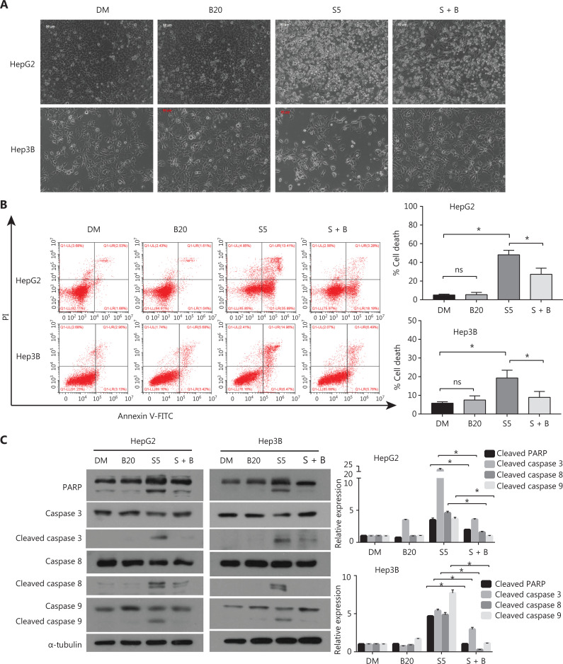 Bilirubin inhibits the anticancer activity of sorafenib by blocking MCL-1 degradation in hepatocellular carcinoma cells.