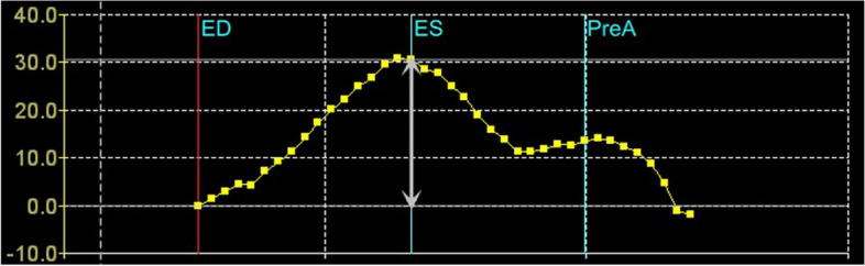 Left atrial morpho-functional remodeling in atrial fibrillation assessed by three dimensional speckle tracking echocardiography and its value in atrial fibrillation screening.
