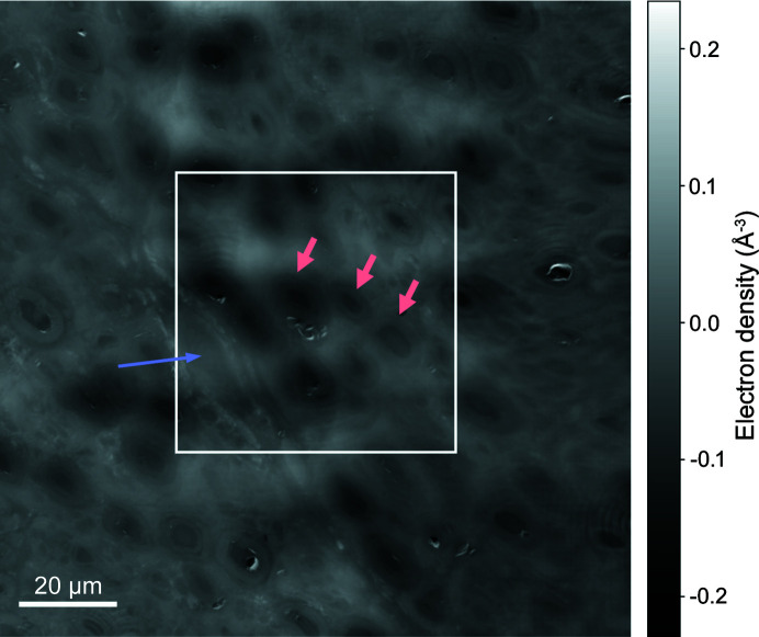 Dose-efficient multimodal microscopy of human tissue at a hard X-ray nanoprobe beamline.