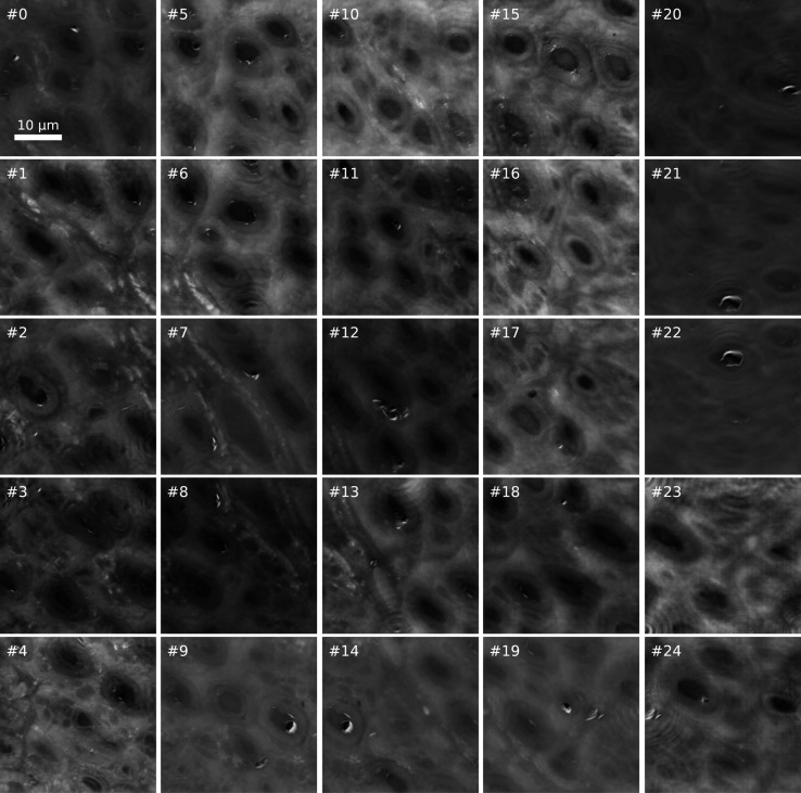 Dose-efficient multimodal microscopy of human tissue at a hard X-ray nanoprobe beamline.