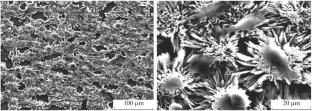 Impact of Silica Concentration on the Calcium Phosphate-Based Composite Coatings Prepared by Pulsed Co-Electrodeposition