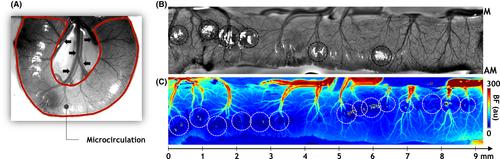 In vivo phenotyping of the microvasculature in necrotizing enterocolitis with multicontrast optical imaging