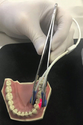Comparison of the vitality tests used in the dental clinical practice and histological analysis of the dental pulp.