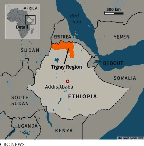 Dialysis Service in the Embattled Tigray Region of Ethiopia: A Call to Action.