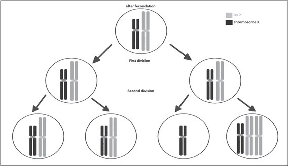 Double Isochromosome X, a Rare Cytogenetic Variant of Turner Syndrome: A Case Report and a Review of the Literature.