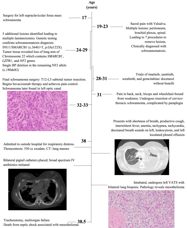 WP1066 induces cell death in a schwannomatosis patient-derived schwannoma cell line.