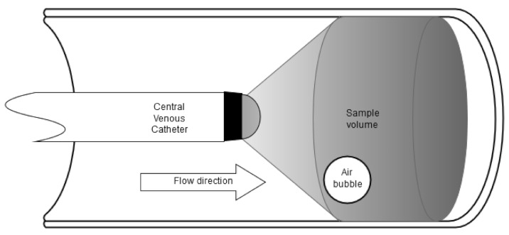 Characterization and comparison of a 2-, 4- and 8-MHz central venous catheter ultrasound probe for venous air emboli detection.