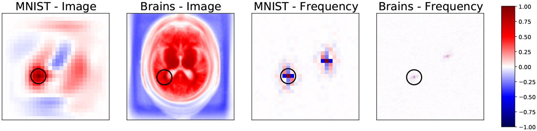 Joint Frequency and Image Space Learning for MRI Reconstruction and Analysis.