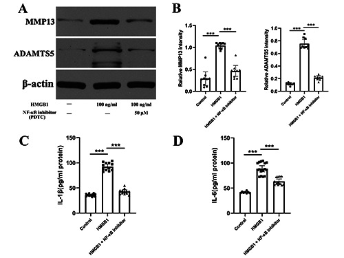 Inhibition of HMGB1 suppresses inflammation and catabolism in temporomandibular joint osteoarthritis <em>via</em> NF-κB signaling pathway.