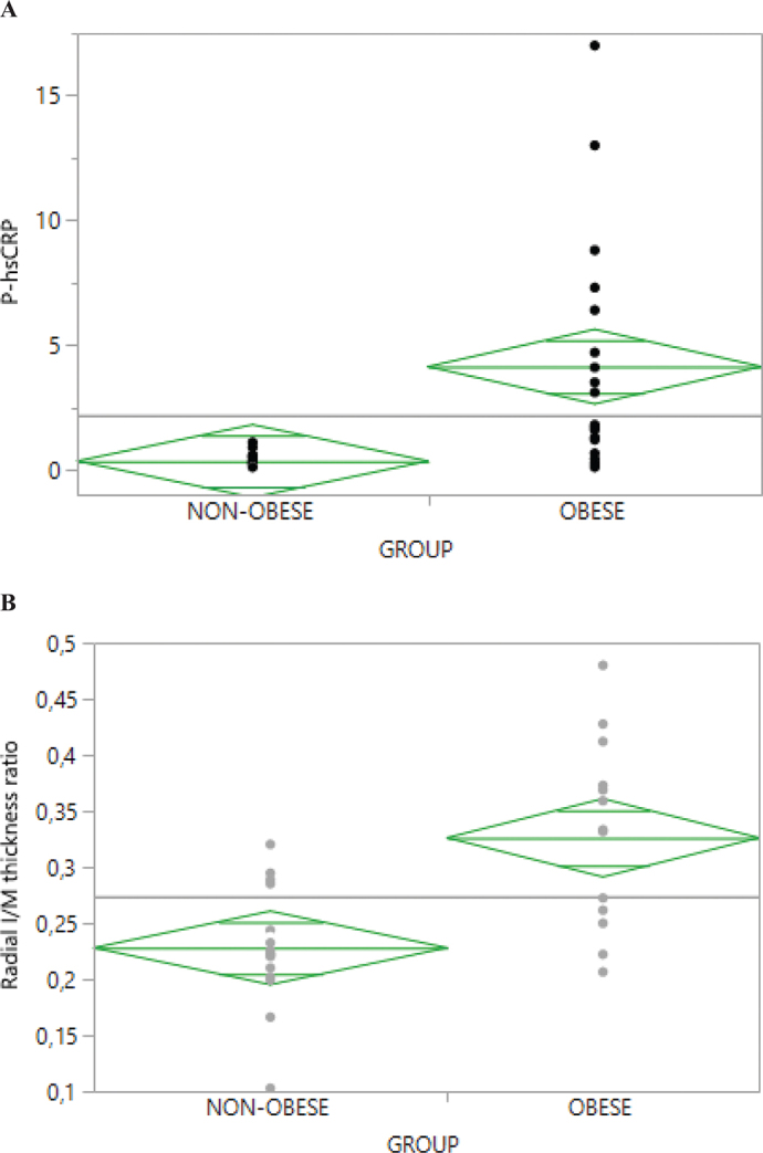 Obesity in adolescents associated with vascular aging - a study using ultra-high-resolution ultrasound.
