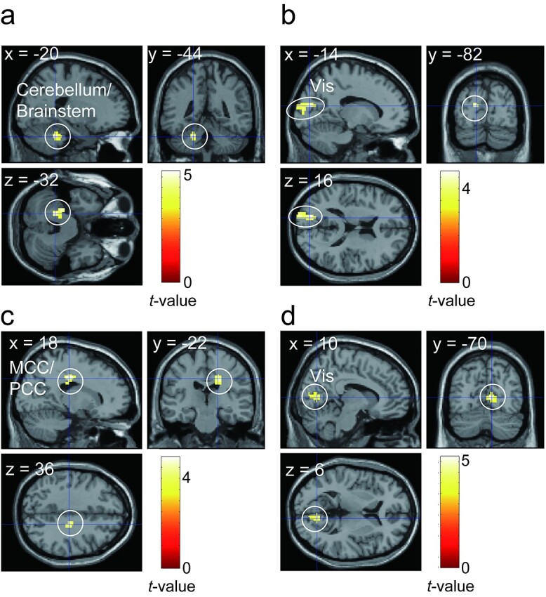 Neural basis for anxiety and anxiety-related physiological responses during a driving situation: an fMRI study.