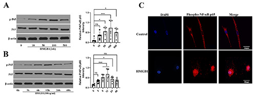 Inhibition of HMGB1 suppresses inflammation and catabolism in temporomandibular joint osteoarthritis <em>via</em> NF-κB signaling pathway.