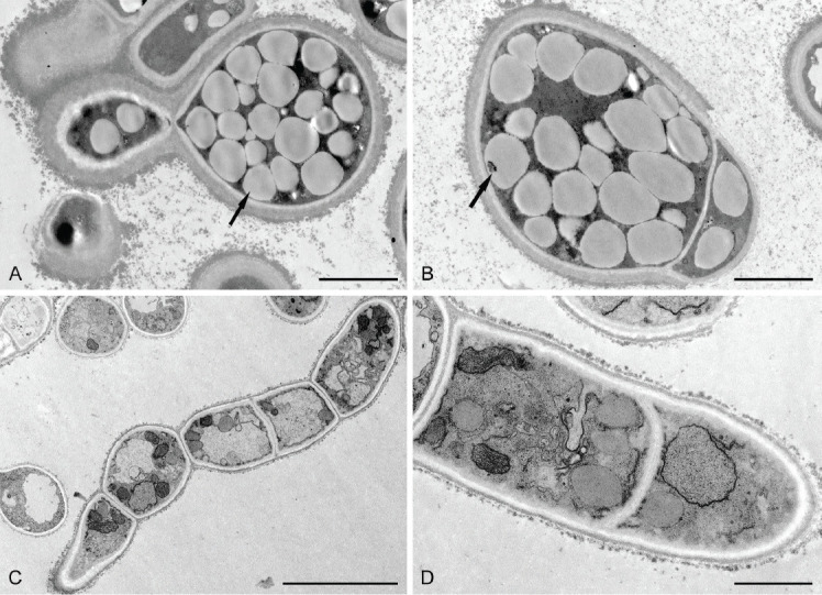 <i>Melanodevriesia</i>, a new genus of endolichenic oleaginous black yeast recovered from the Inner Mongolia Region of China.