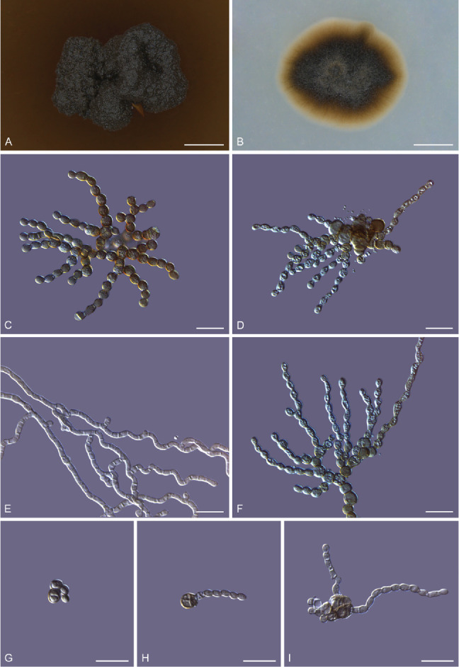 <i>Melanodevriesia</i>, a new genus of endolichenic oleaginous black yeast recovered from the Inner Mongolia Region of China.