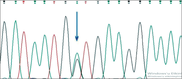 Frequencies of the <i>MEFV</i> Gene Mutations in Azerbaijan.