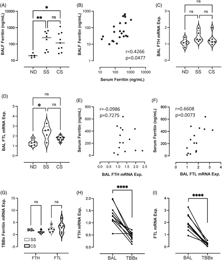 Excess iron promotes emergence of foamy macrophages that overexpress ferritin in the lungs of silicosis patients.