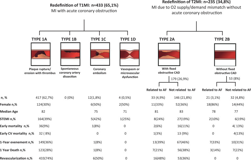 Preexisting atrial fibrillation and myocardial infarction: only 10% of infarcts directly linked to atrial fibrillation.