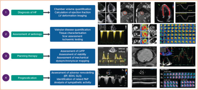The Role of Cardiac Imaging in Heart Failure with Reduced Ejection Fraction.