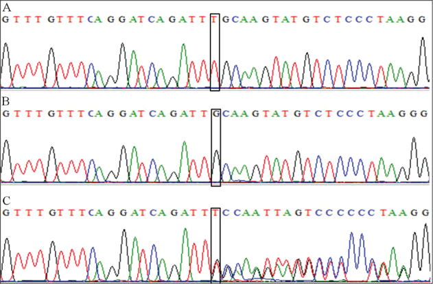 Novel <i>GPC3</i> Gene Mutation in Simpson-Golabi-Behmel Syndrome with Endocrine Anomalies: A Case Report.