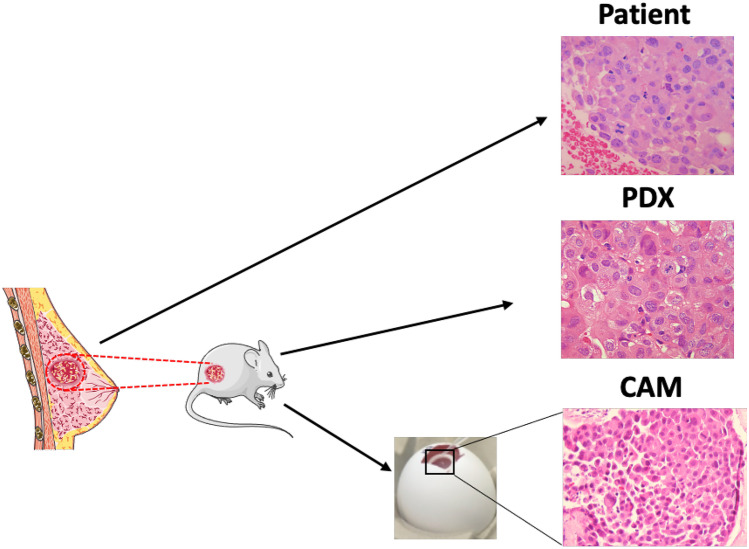 In Vivo Modeling of Human Breast Cancer Using Cell Line and Patient-Derived Xenografts.