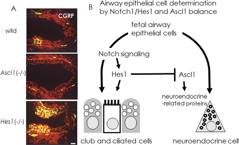 Pulmonary Neuroendocrine Cells and Small Cell Lung Carcinoma: Immunohistochemical Study Focusing on Mechanisms of Neuroendocrine Differentiation.