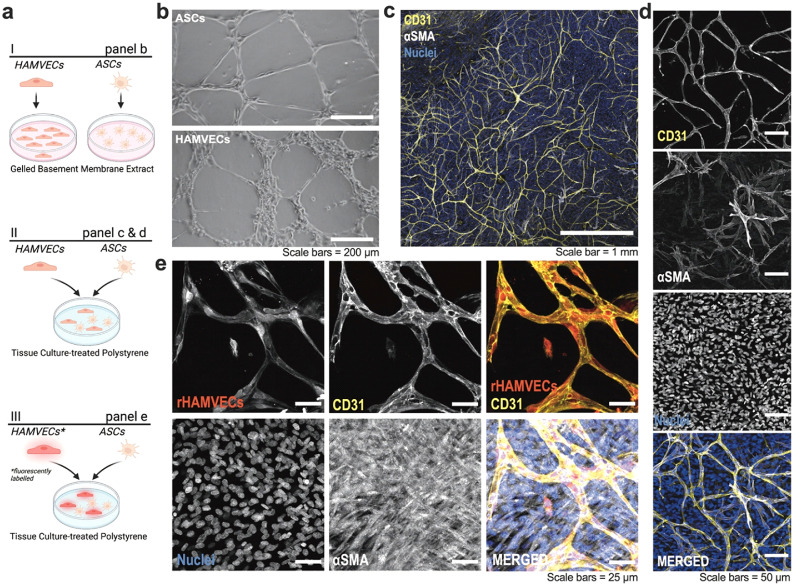 Vascular tissue engineering from human adipose tissue: fundamental phenotype of its resident microvascular endothelial cells and stromal/stem cells