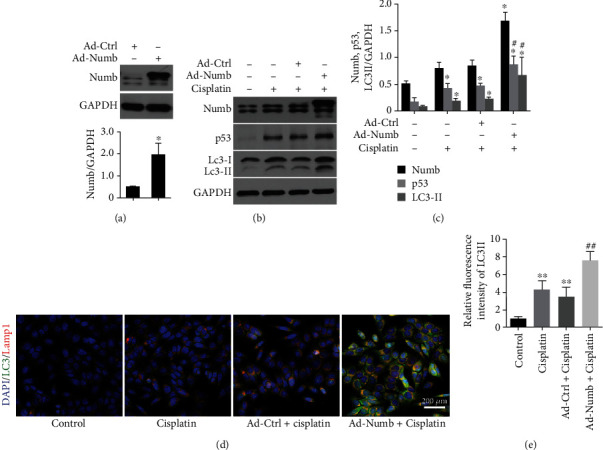 Numb Promotes Autophagy through p53 Pathway in Acute Kidney Injury Induced by Cisplatin.