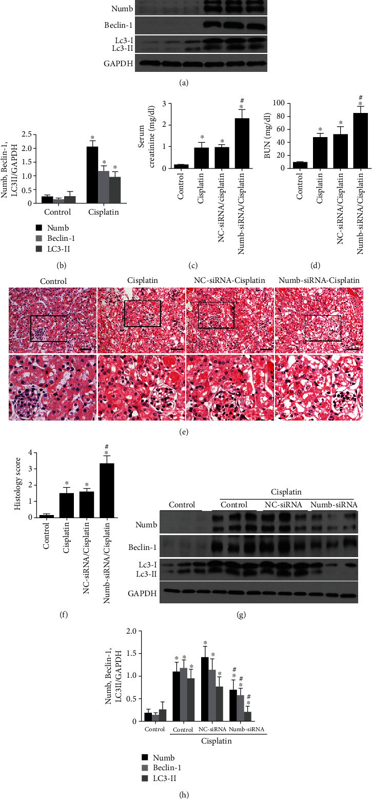 Numb Promotes Autophagy through p53 Pathway in Acute Kidney Injury Induced by Cisplatin.