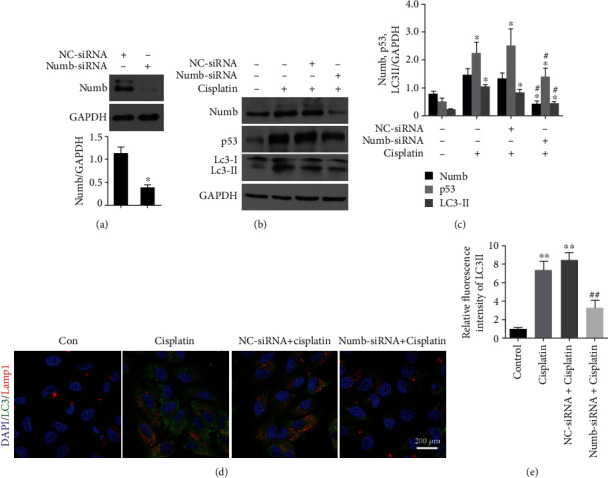 Numb Promotes Autophagy through p53 Pathway in Acute Kidney Injury Induced by Cisplatin.