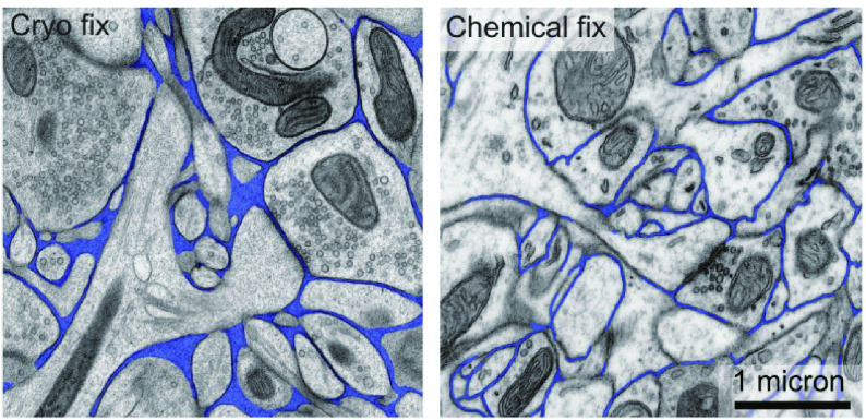 Brain structure and structural basis of neurodegenerative diseases.