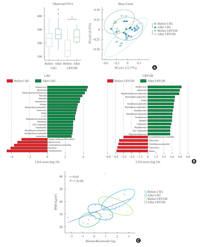 Association between the Blautia/Bacteroides Ratio and Altered Body Mass Index after Bariatric Surgery.