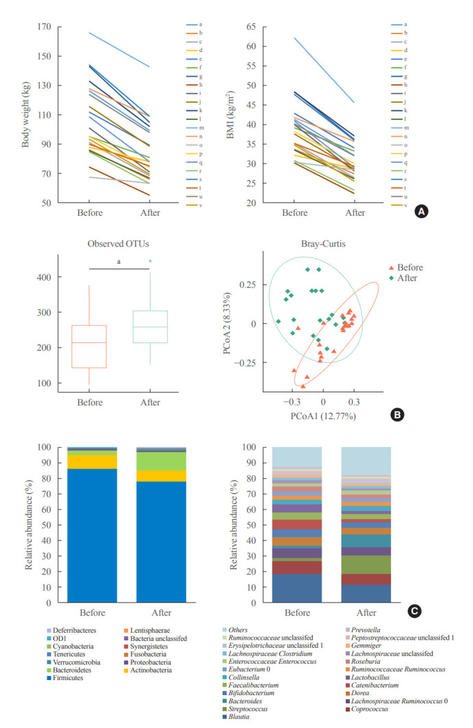 Association between the Blautia/Bacteroides Ratio and Altered Body Mass Index after Bariatric Surgery.