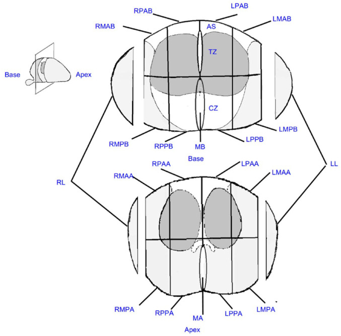 Schema and cancer detection rates for transperineal prostate biopsy templates: a review.