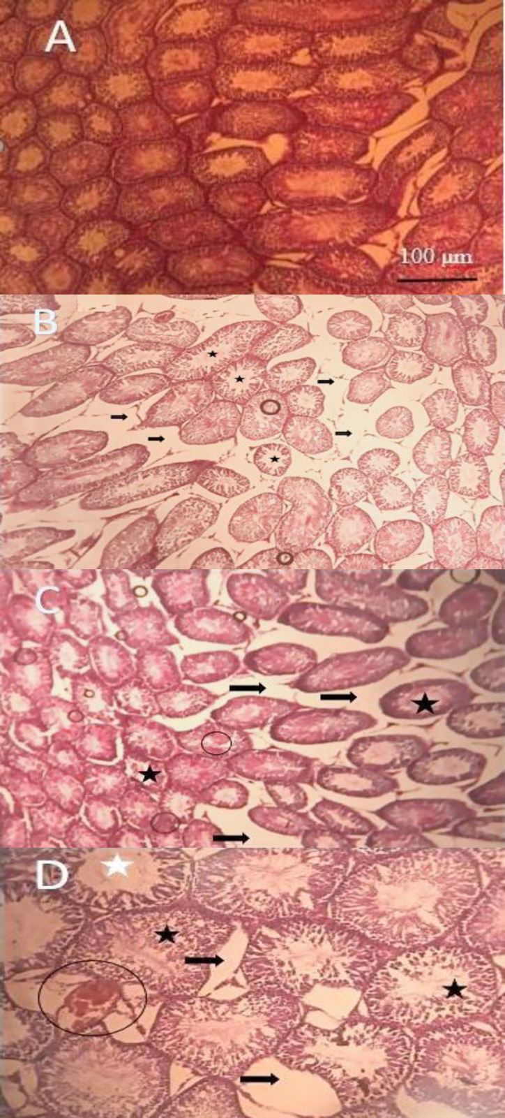 Concurrent Lead and Noise Exposure Effects on Testicular Tissue of Rat: An Experimental Study.
