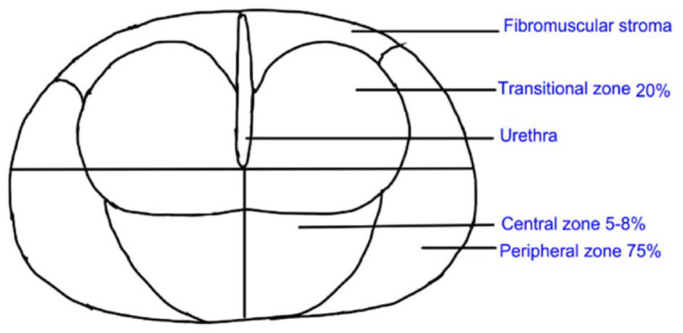 Schema and cancer detection rates for transperineal prostate biopsy templates: a review.