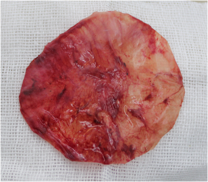 A canine model of aortic arch aneurysm created with autologous pericardium