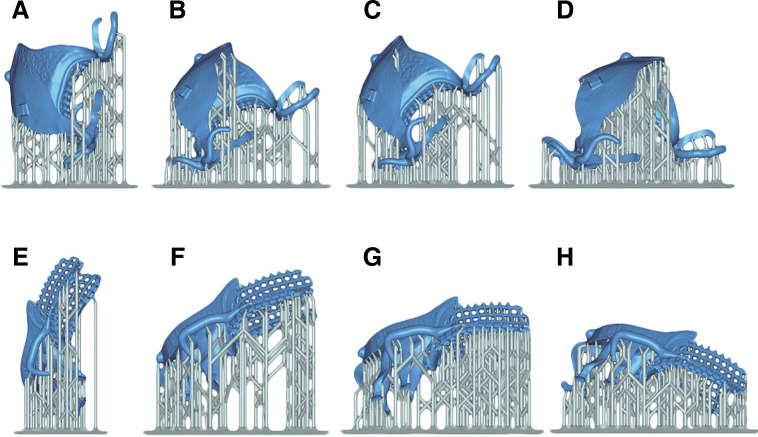 Trueness of 3D printed partial denture frameworks: build orientations and support structure density parameters.