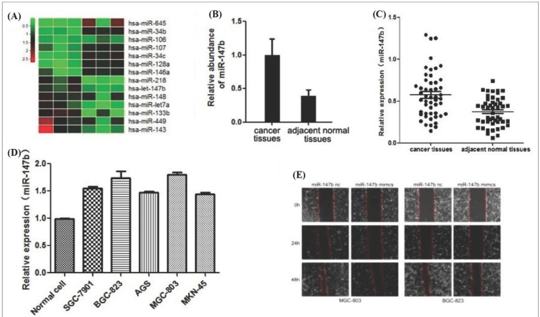 <i>MIR-147B</i> Regulated Proliferation and Apoptosis of Gastric Cancer Cells by Targeting <i>CPEB2</i> Via the PTEN Pathway.