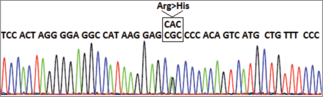 <i>de Novo TINF2</i> C.845G>A: Pathogenic Variant in Patient with Dyskeratosis Congenita.