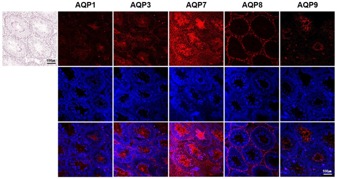 Differential Expressions of Aquaporin Subtypes in the Adult Mouse Testis.