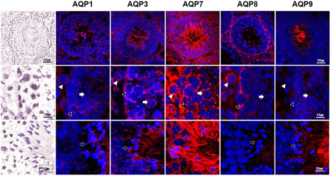 Differential Expressions of Aquaporin Subtypes in the Adult Mouse Testis.