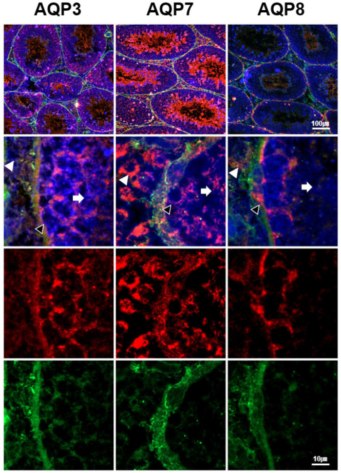 Differential Expressions of Aquaporin Subtypes in the Adult Mouse Testis.