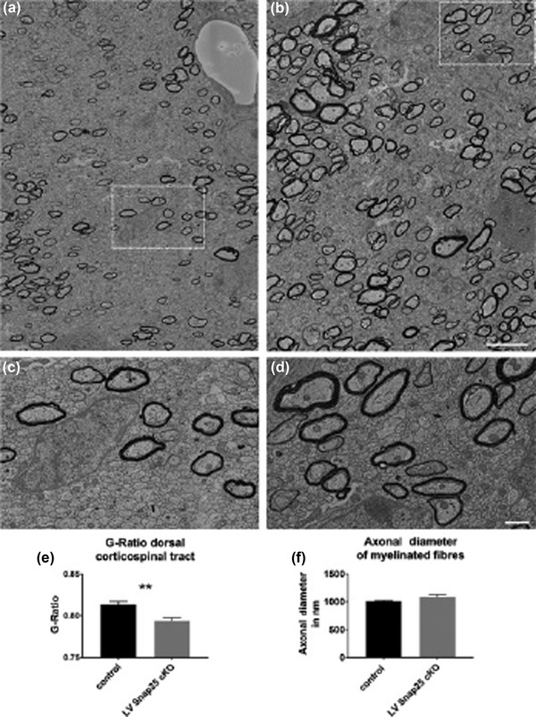 The role of snare proteins in cortical development