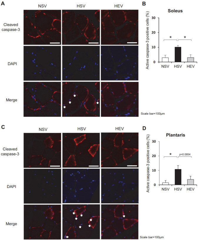 Aerobic exercise prevents apoptosis in skeletal muscles of high-fat-fed ovariectomized rats.