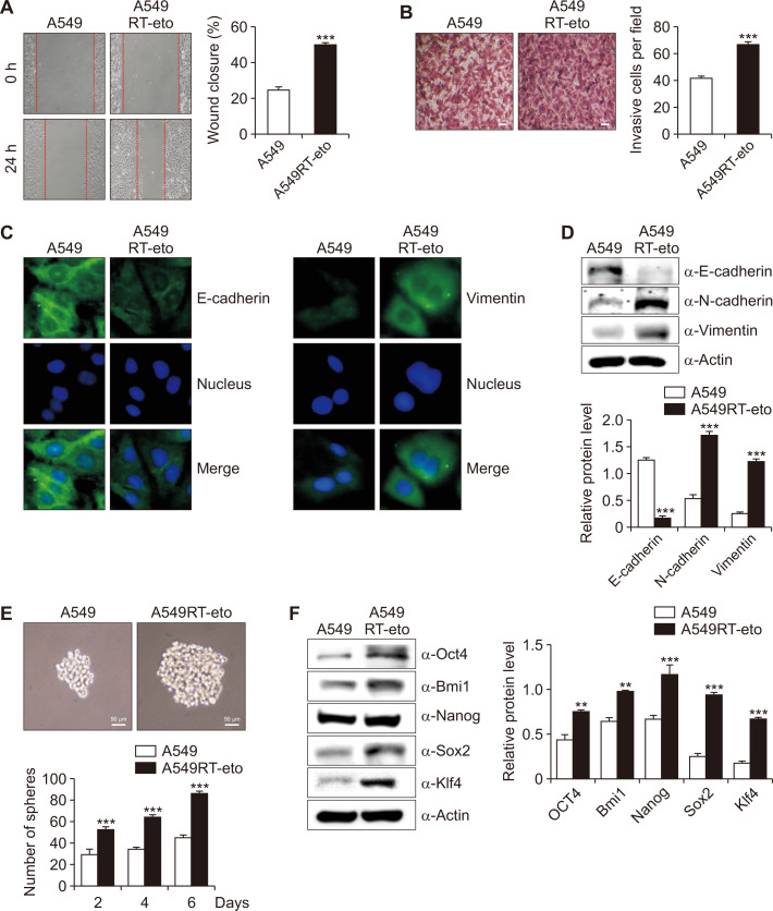 Formoxanthone C Inhibits Malignant Tumor Phenotypes of Human A549 Multidrug Resistant-cancer Cells through Signal Transducer and Activator of Transcription 1-Histone Deacetylase 4 Signaling.