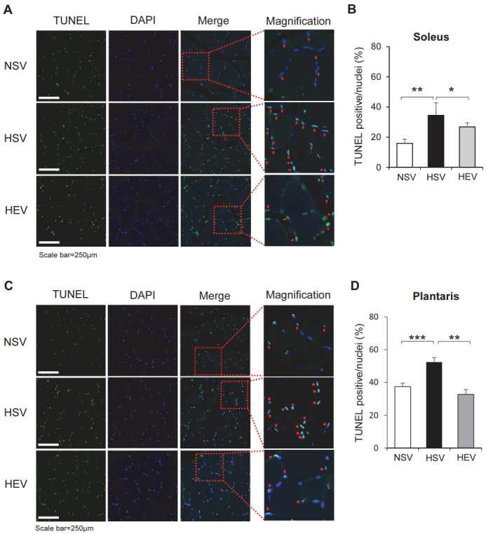 Aerobic exercise prevents apoptosis in skeletal muscles of high-fat-fed ovariectomized rats.