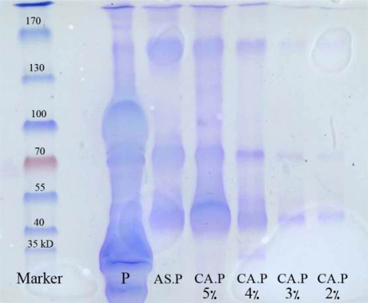 Purification of Therapeutic Serums of Snake Anti-Venom with Caprylic Acid.