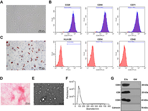 Extracellular vesicles from bone mesenchymal stem cells transport microRNA-206 into osteosarcoma cells and target NRSN2 to block the ERK1/2-Bcl-xL signaling pathway.