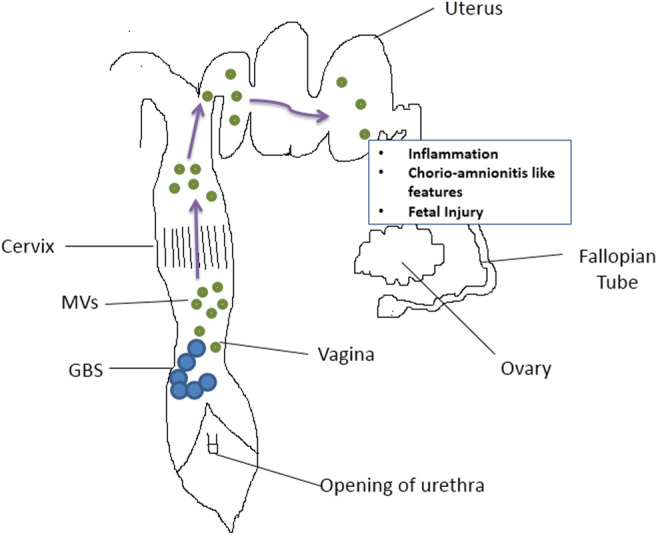 Mechanisms of group B <i>Streptococcus</i>-mediated preterm birth: lessons learnt from animal models.